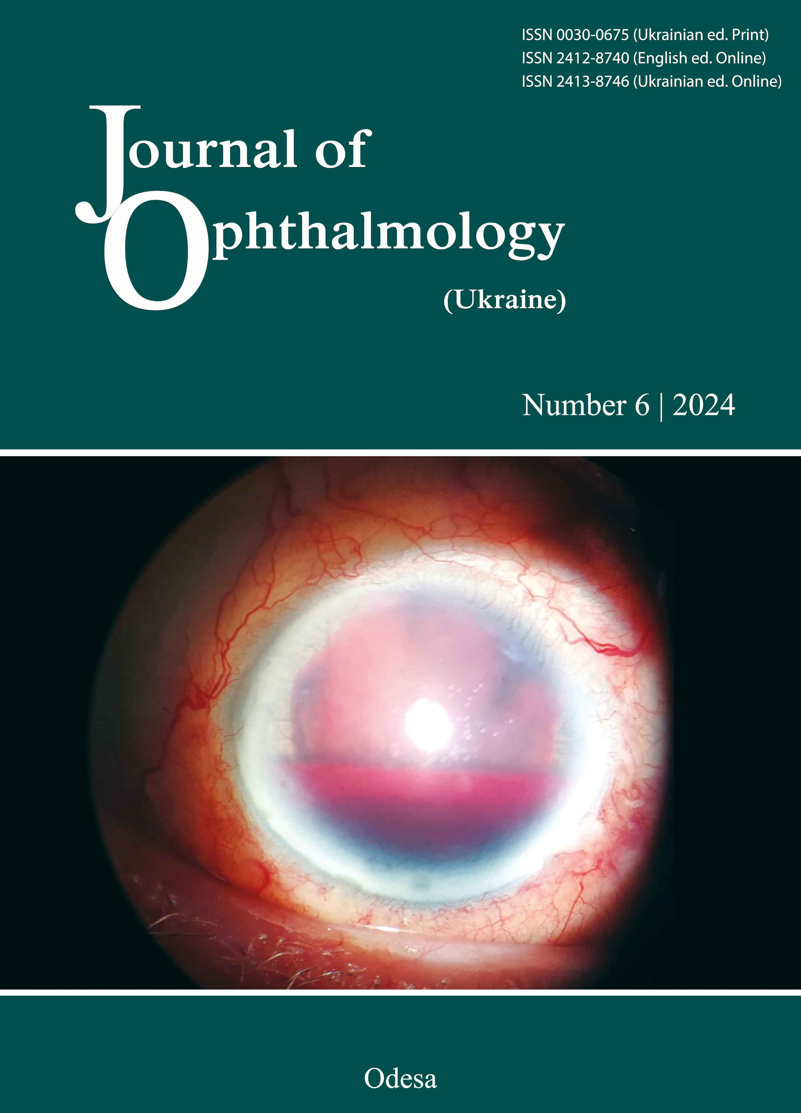 					View No. 6 (2024): Journal of Ophthalmology (Ukraine)
				