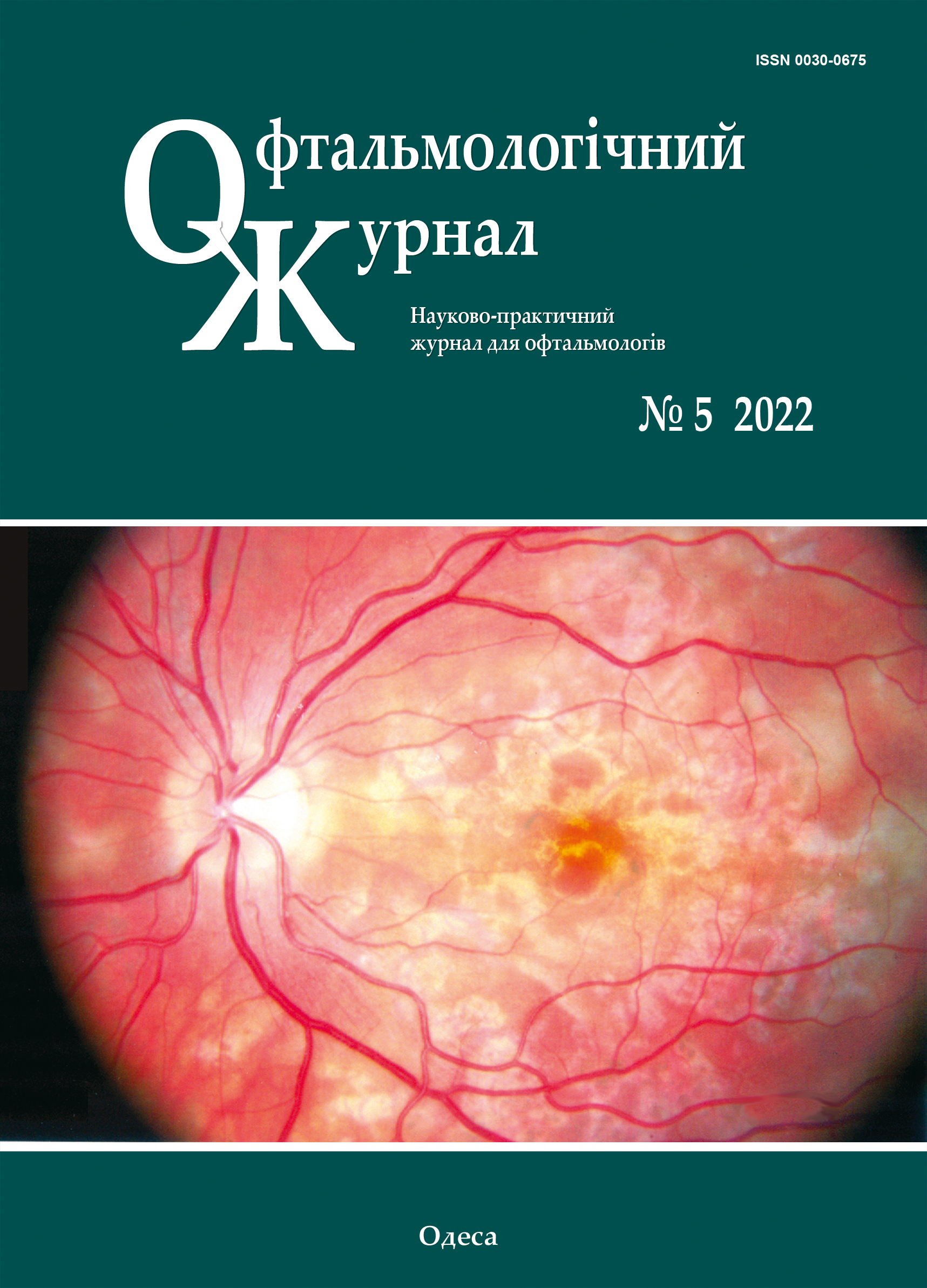 					View No. 5 (2022): Journal of Ophthalmology (Ukraine)
				