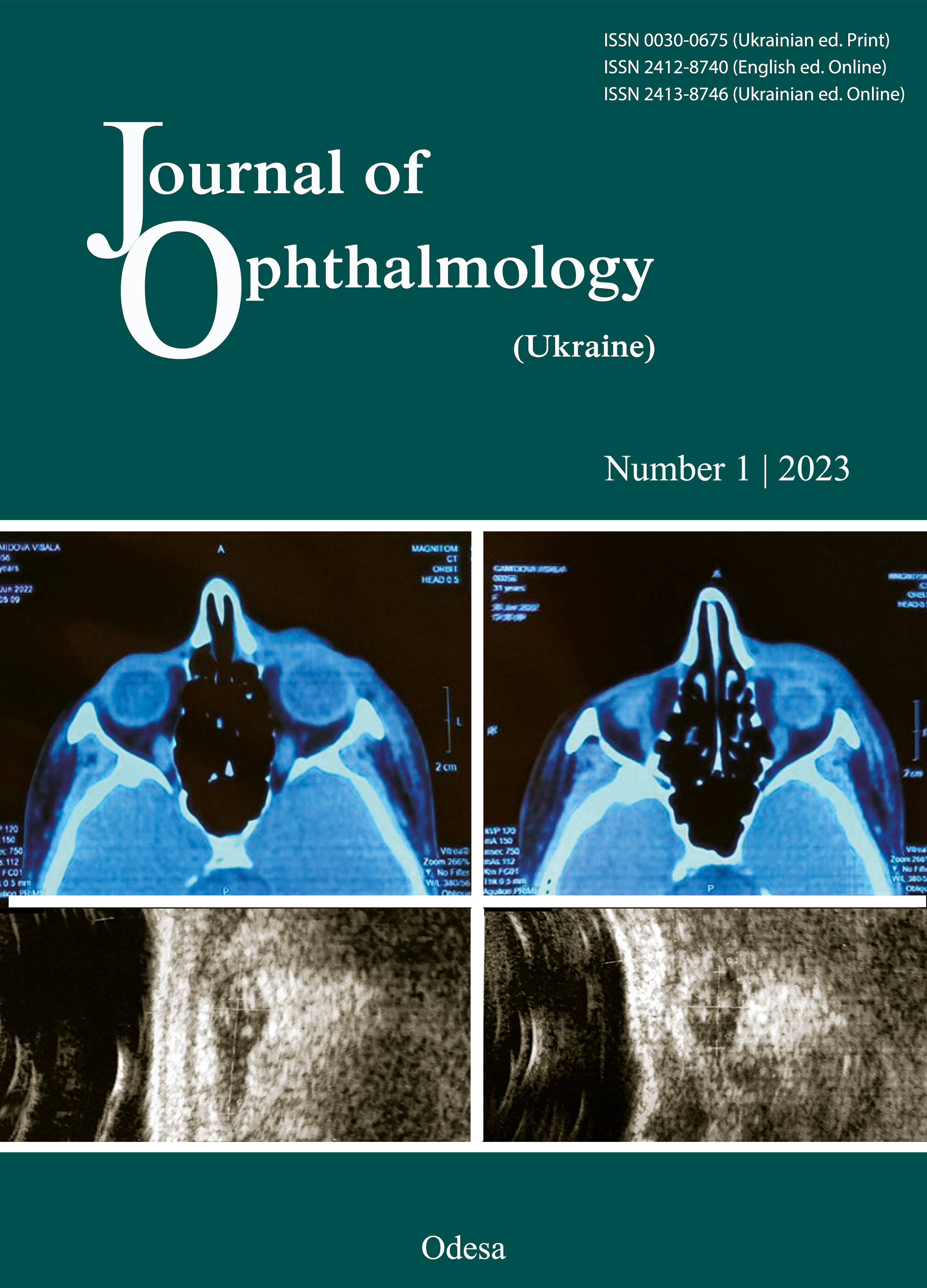 					View No. 1 (2023): Journal of Ophthalmology (Ukraine) 
				
