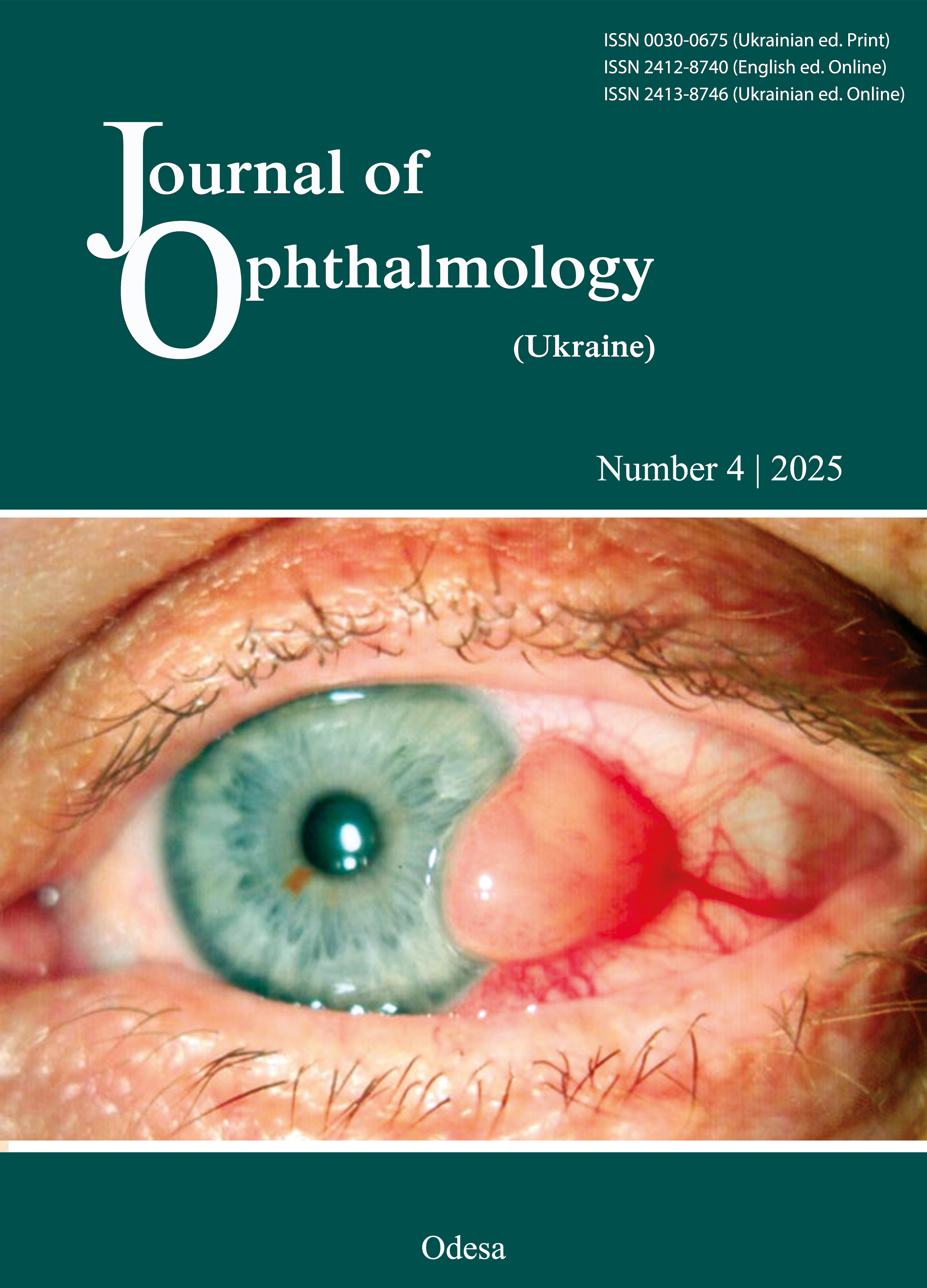 					View No. 4 (2025): Journal of Ophthalmology (Ukraine)
				