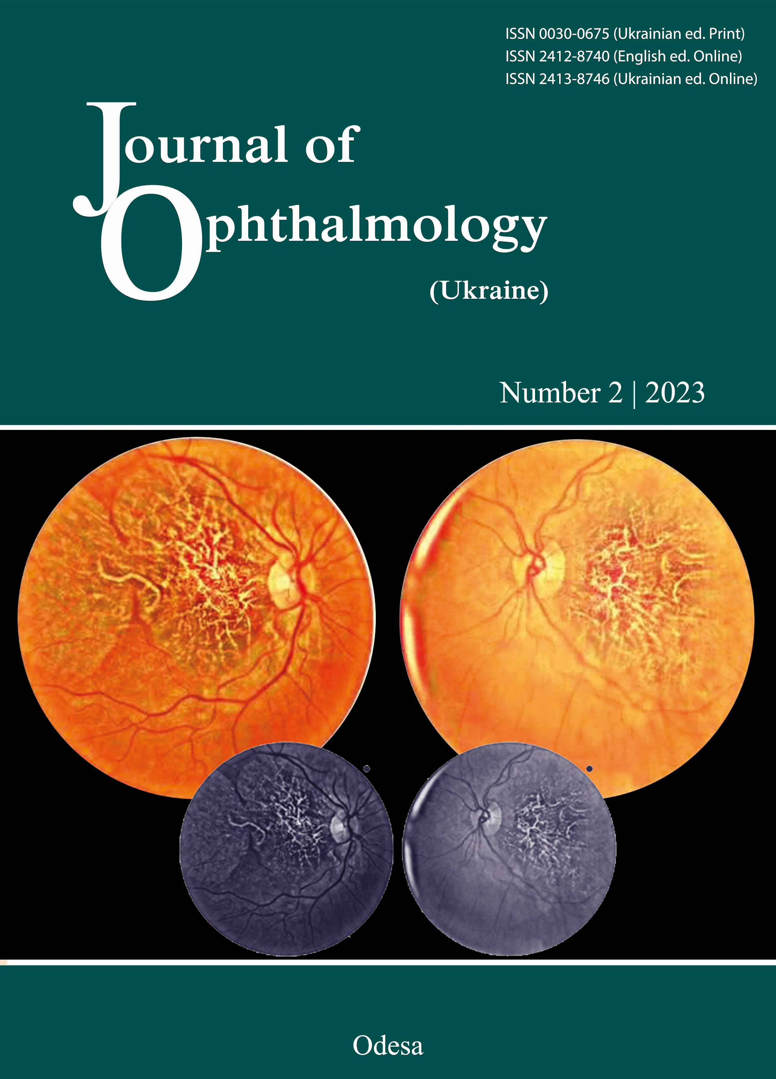 					View No. 2 (2023): Journal of Ophthalmology (Ukraine) 
				