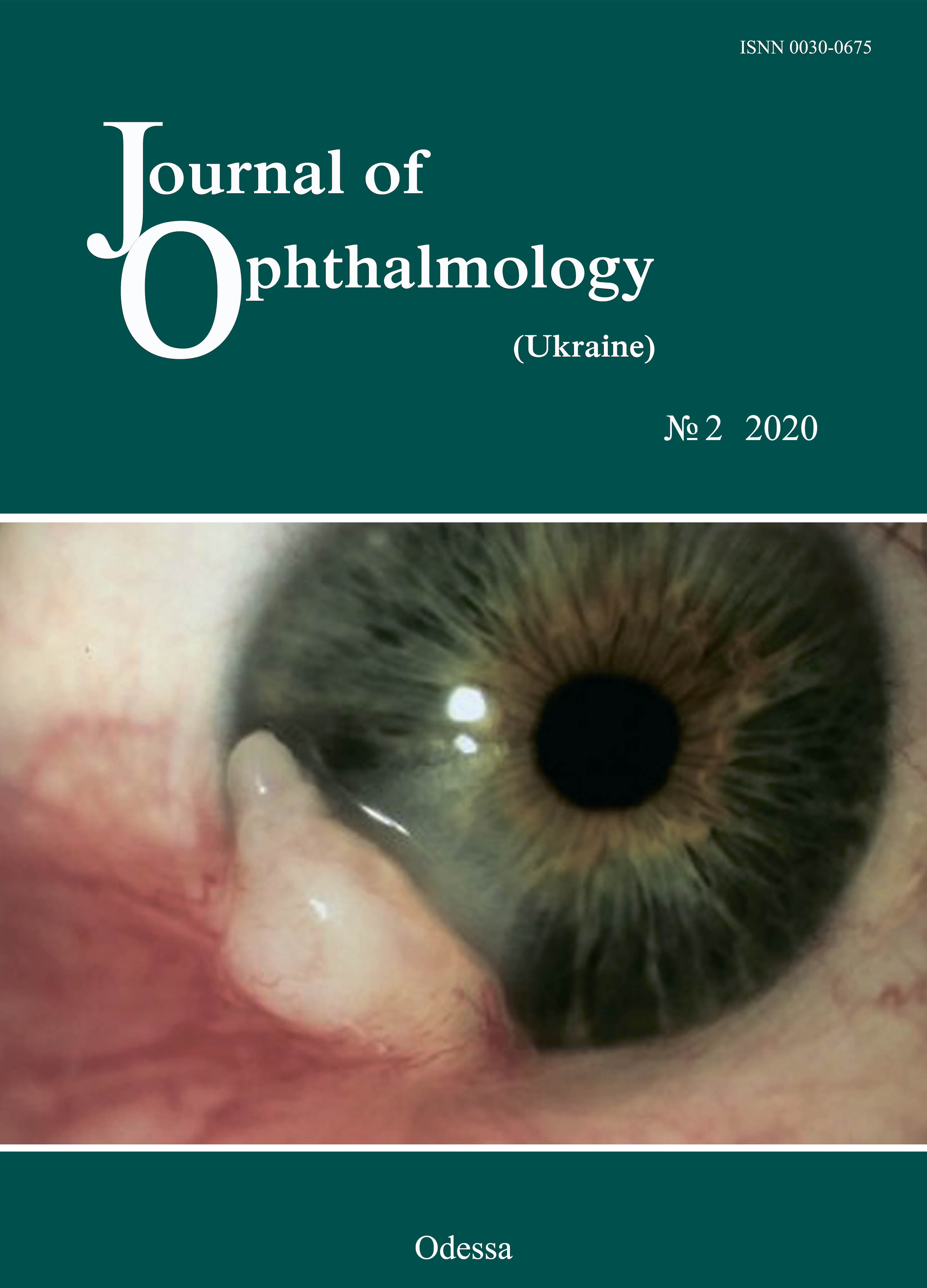 					View No. 2 (2020): Journal of Ophthalmology (Ukraine)
				