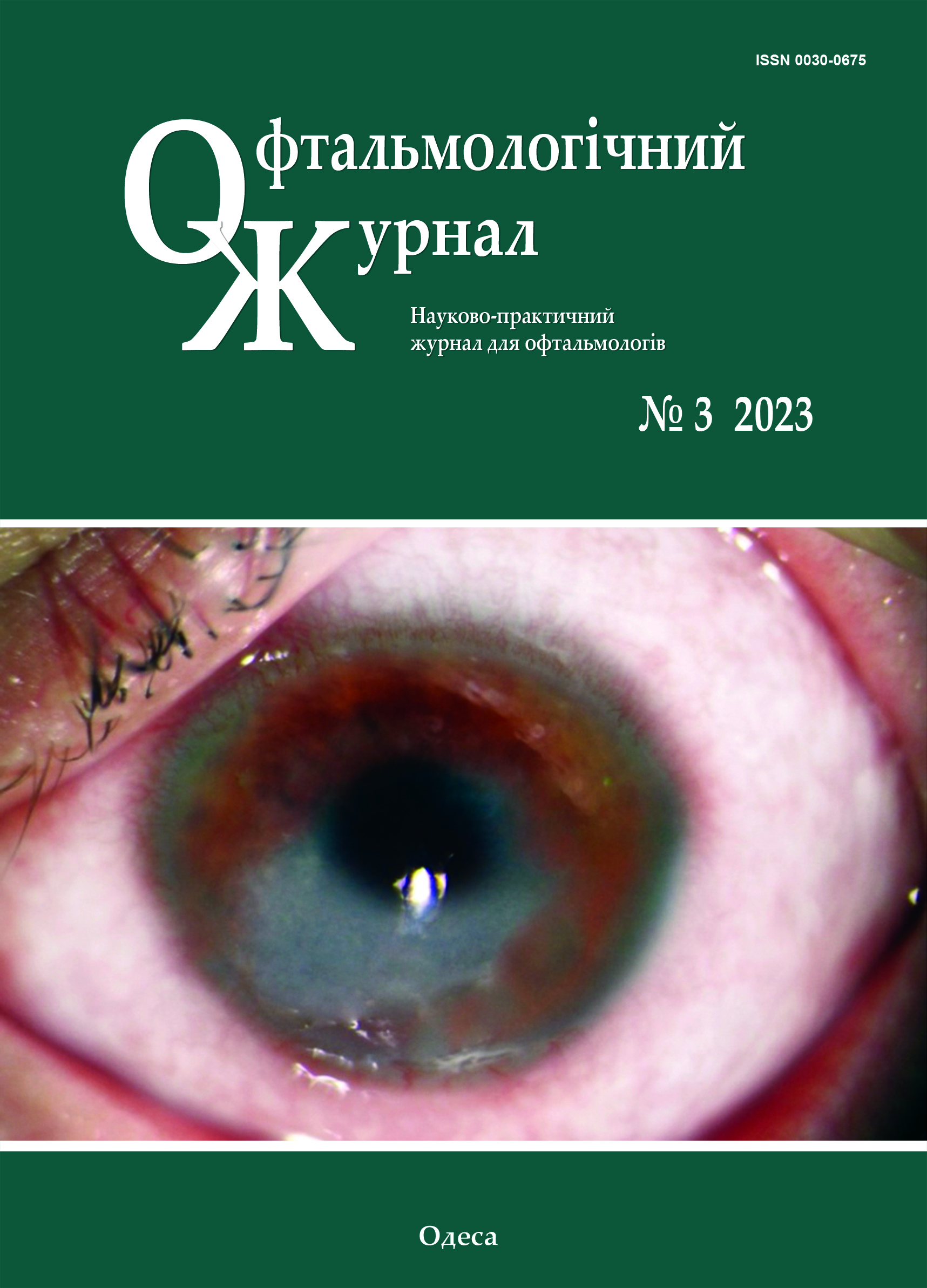 					View No. 3 (2023): Journal of Ophthalmology (Ukraine)
				