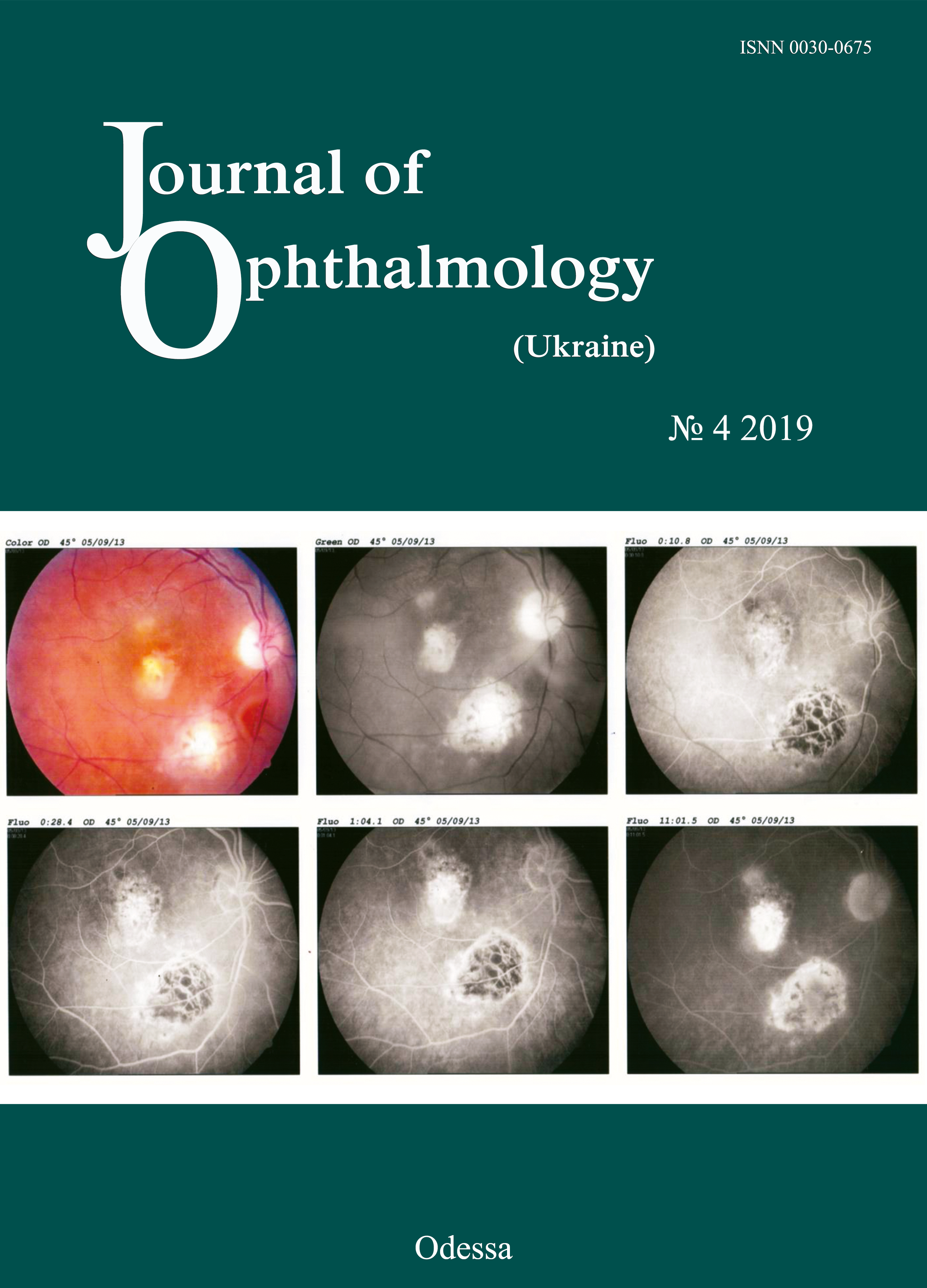 					View No. 4 (2019): Journal of Ophthalmology (Ukraine)
				