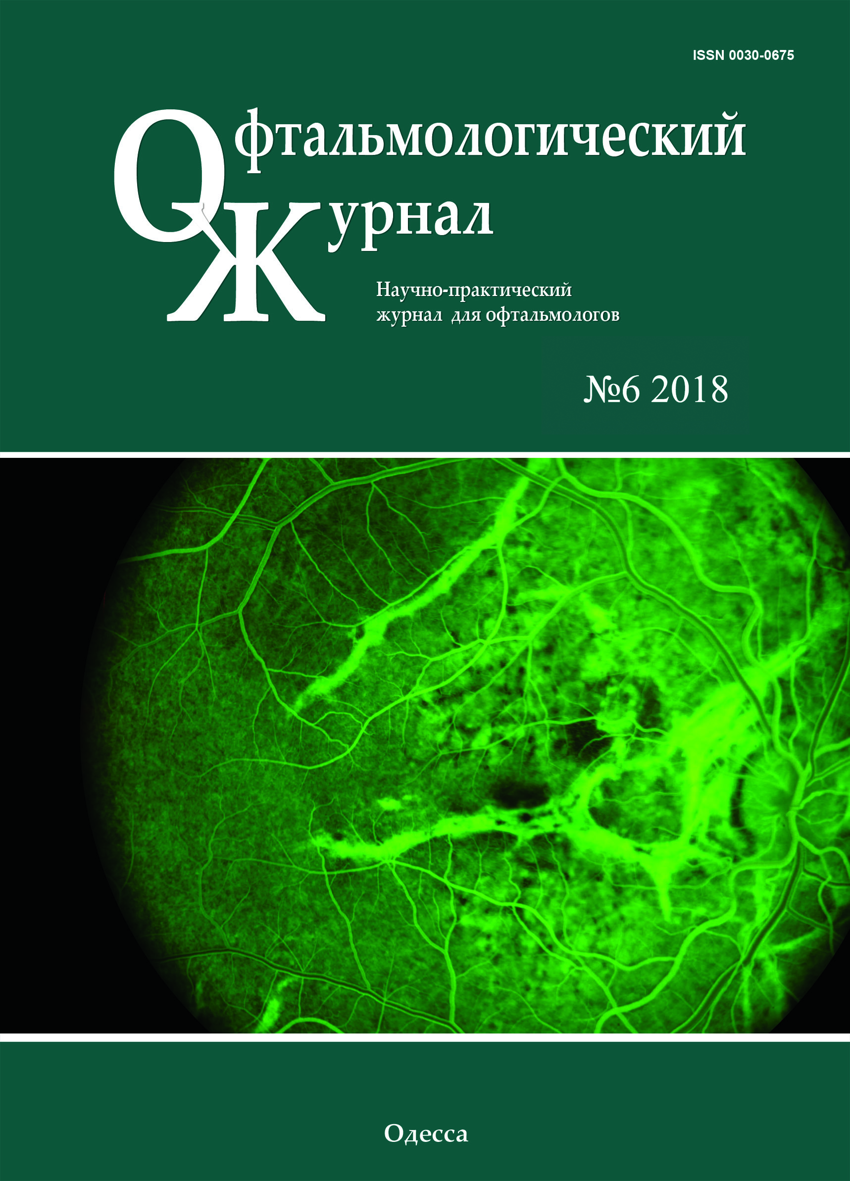 					##issue.viewIssueIdentification##
				