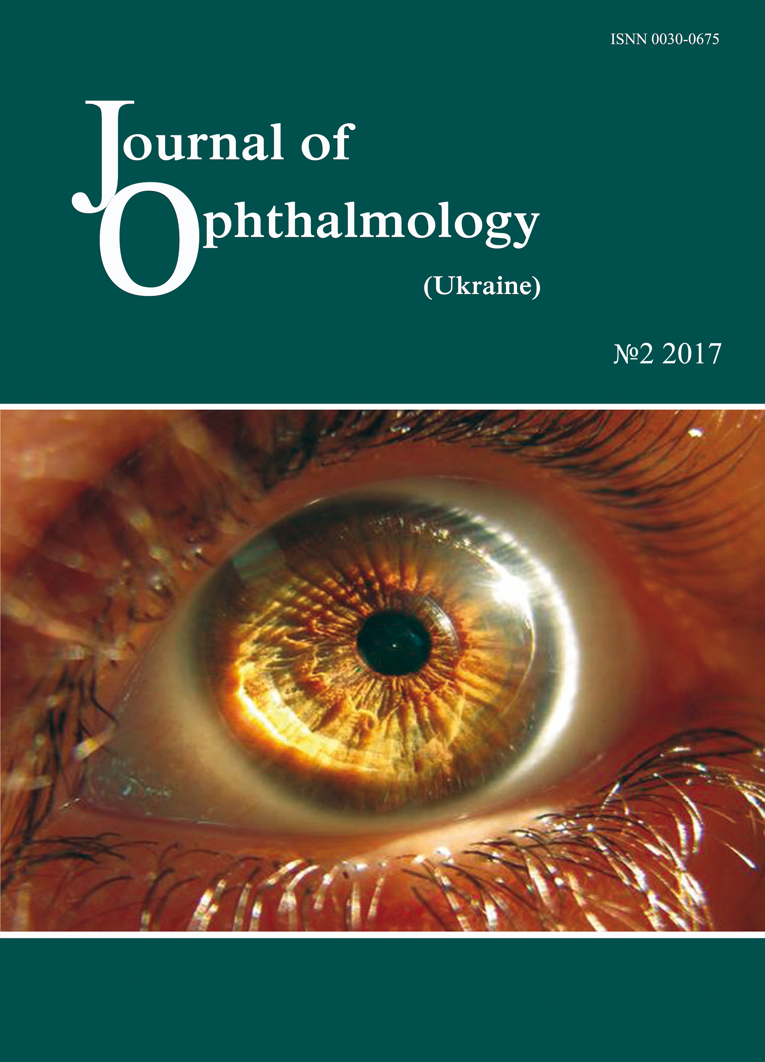 					View No. 2 (2017): Journal of Ophthalmology (Ukraine)
				