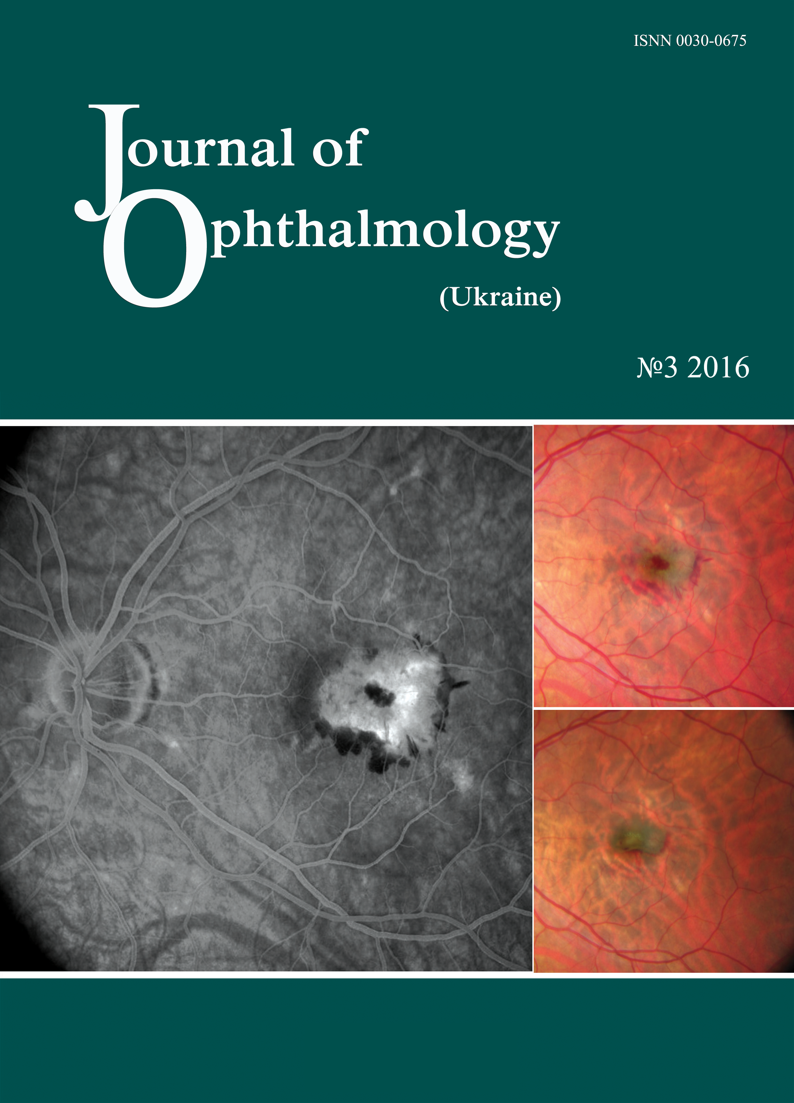 					View No. 3 (2016): Journal of Ophthalmology (Ukraine)
				