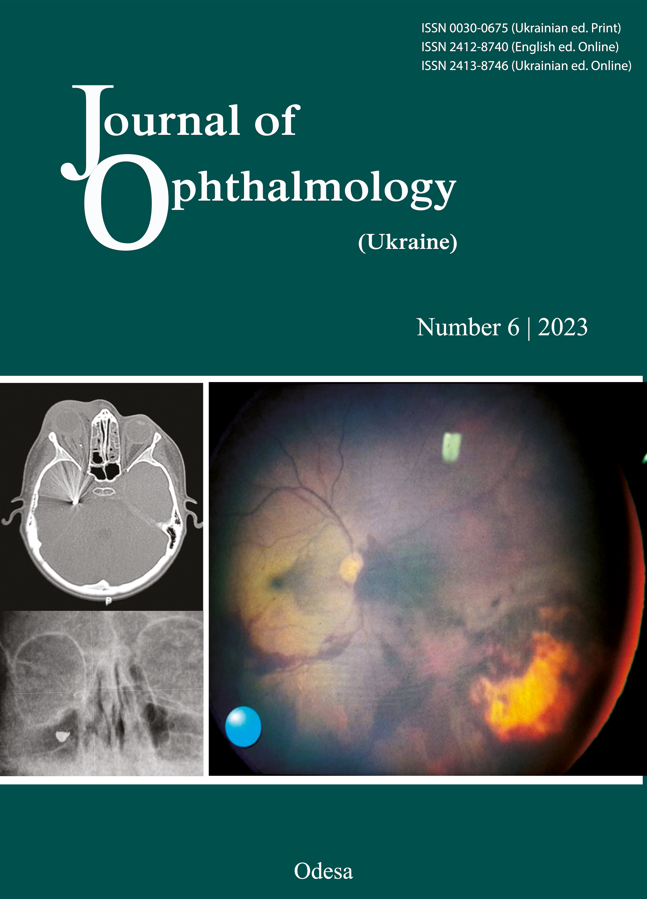 					View No. 6 (2023): Journal of Ophthalmology (Ukraine)
				