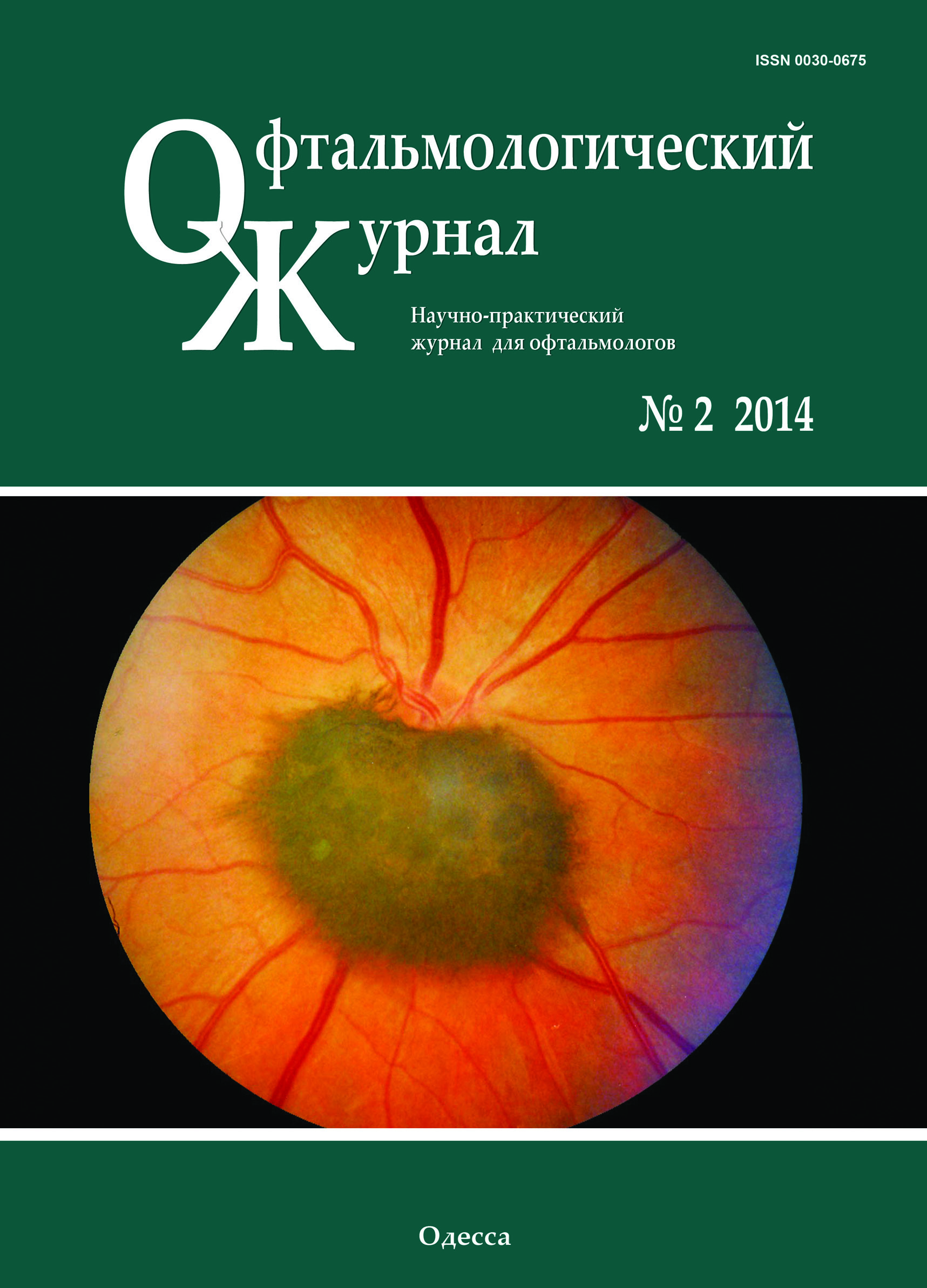 					View No. 2 (2014): Journal of Ophthalmology (Ukraine)
				