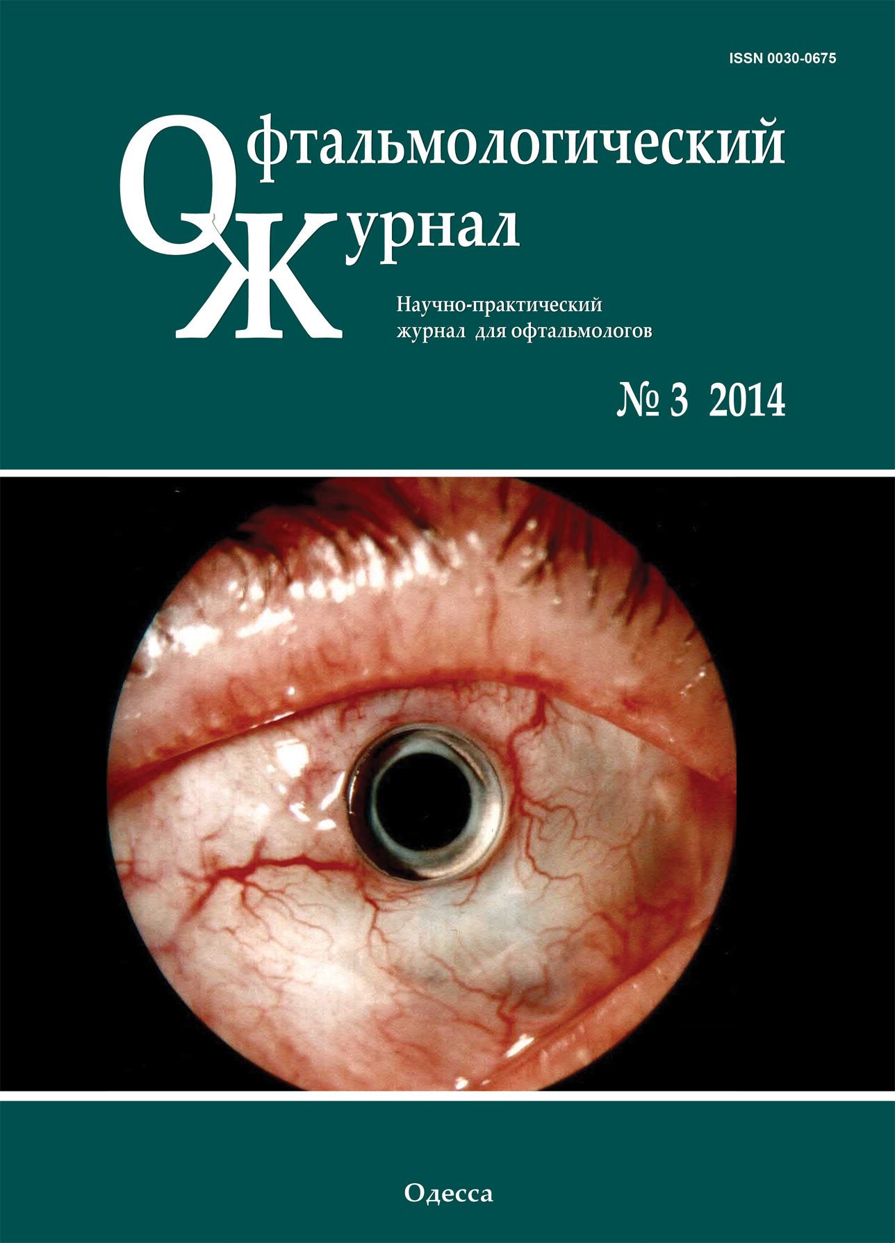 					View No. 3 (2014): Journal of Ophthalmology (Ukraine)
				