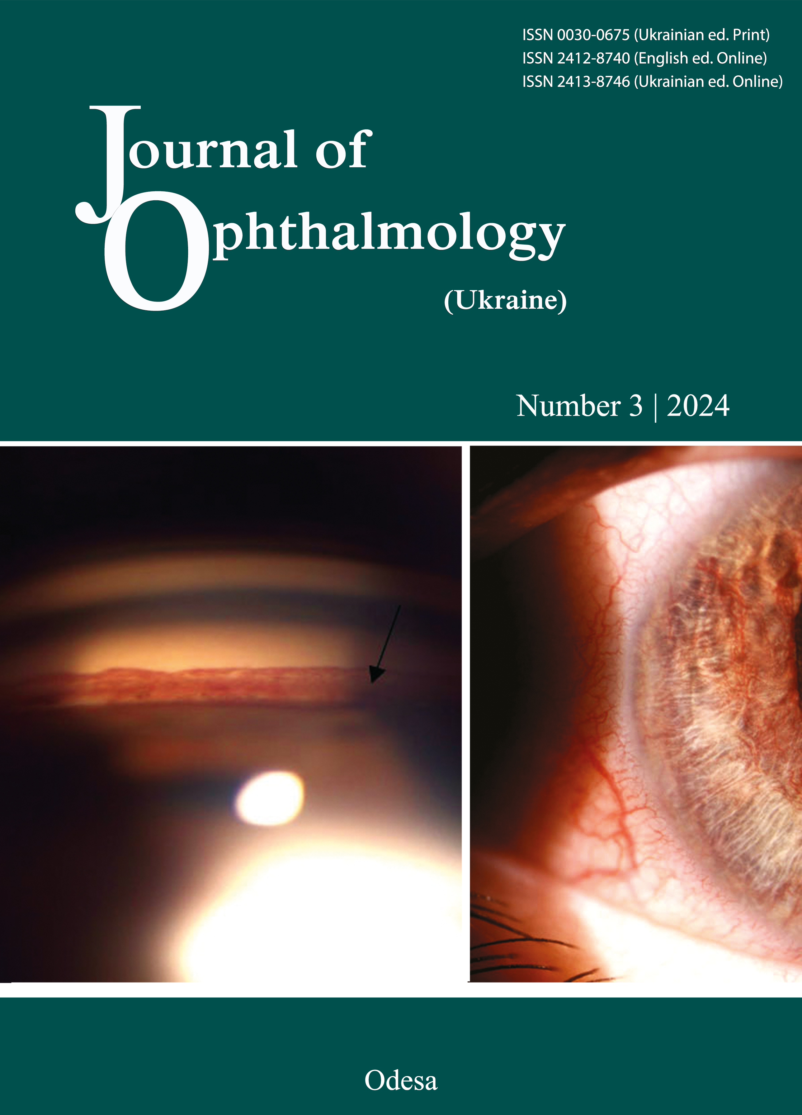 					View No. 3 (2024): Journal of Ophthalmology (Ukraine)
				